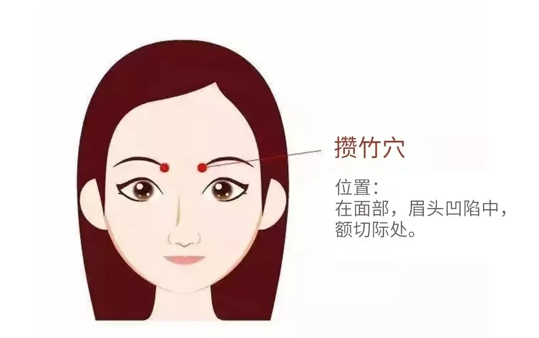 攒竹穴示意图